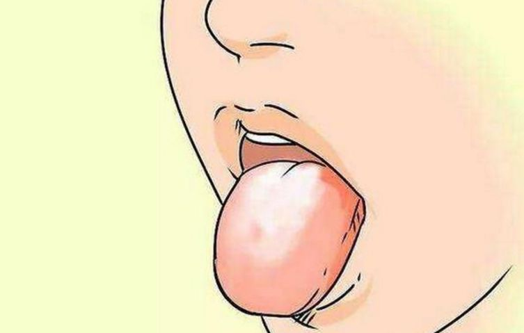 重庆市中医馆的老中医罗登祥教你们通过舌苔看健康
