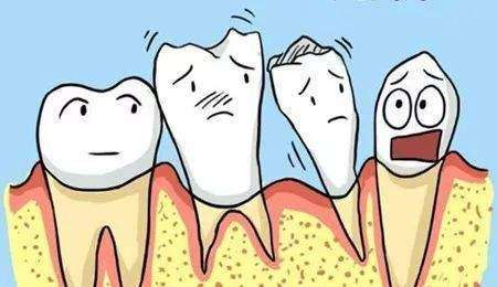 牙周炎早期有什么症状,怎么解决