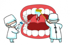 牙周炎增加肺癌风险，可以预防。