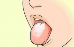 舌苔异常预示着什么样的胃病。