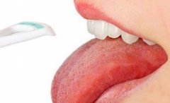 舌苔异常的症状有哪些,重庆老中医治疗